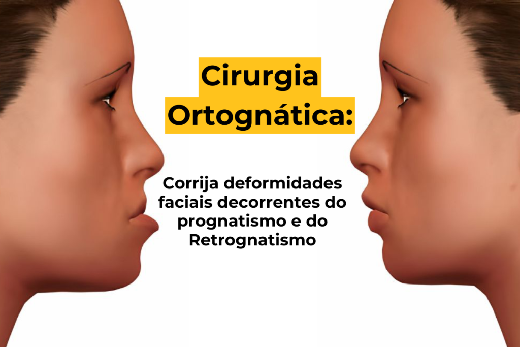 Cirurgia Ortognática em Maringá: Corrija Deformidades Faciais